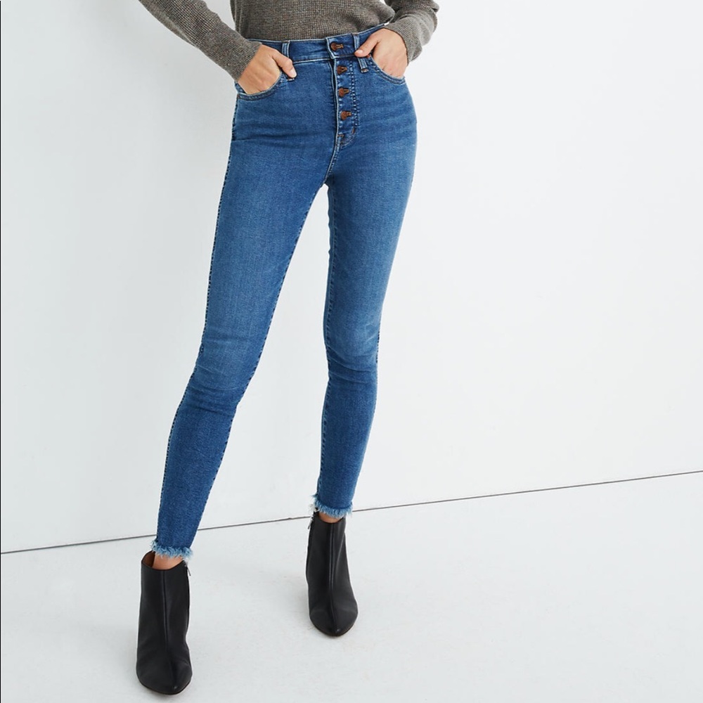 Madewell 10” High Rise Skinny